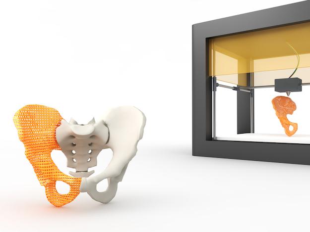 impressao3D
